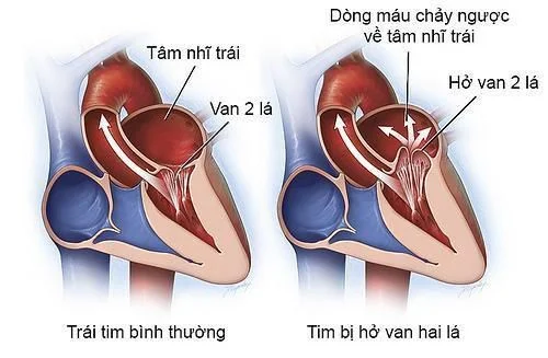 Hình ảnh minh họa (2)