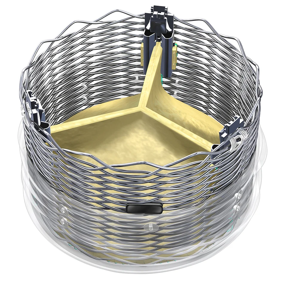 mvalve