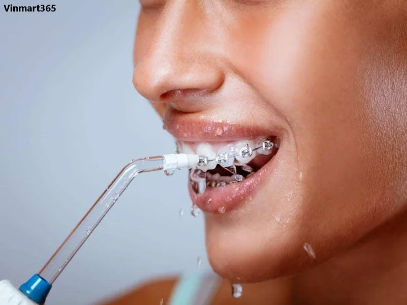 Máy tăm nước cho người niềng răng