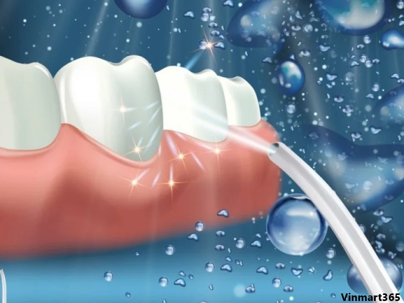Máy tăm nước Waterpik
